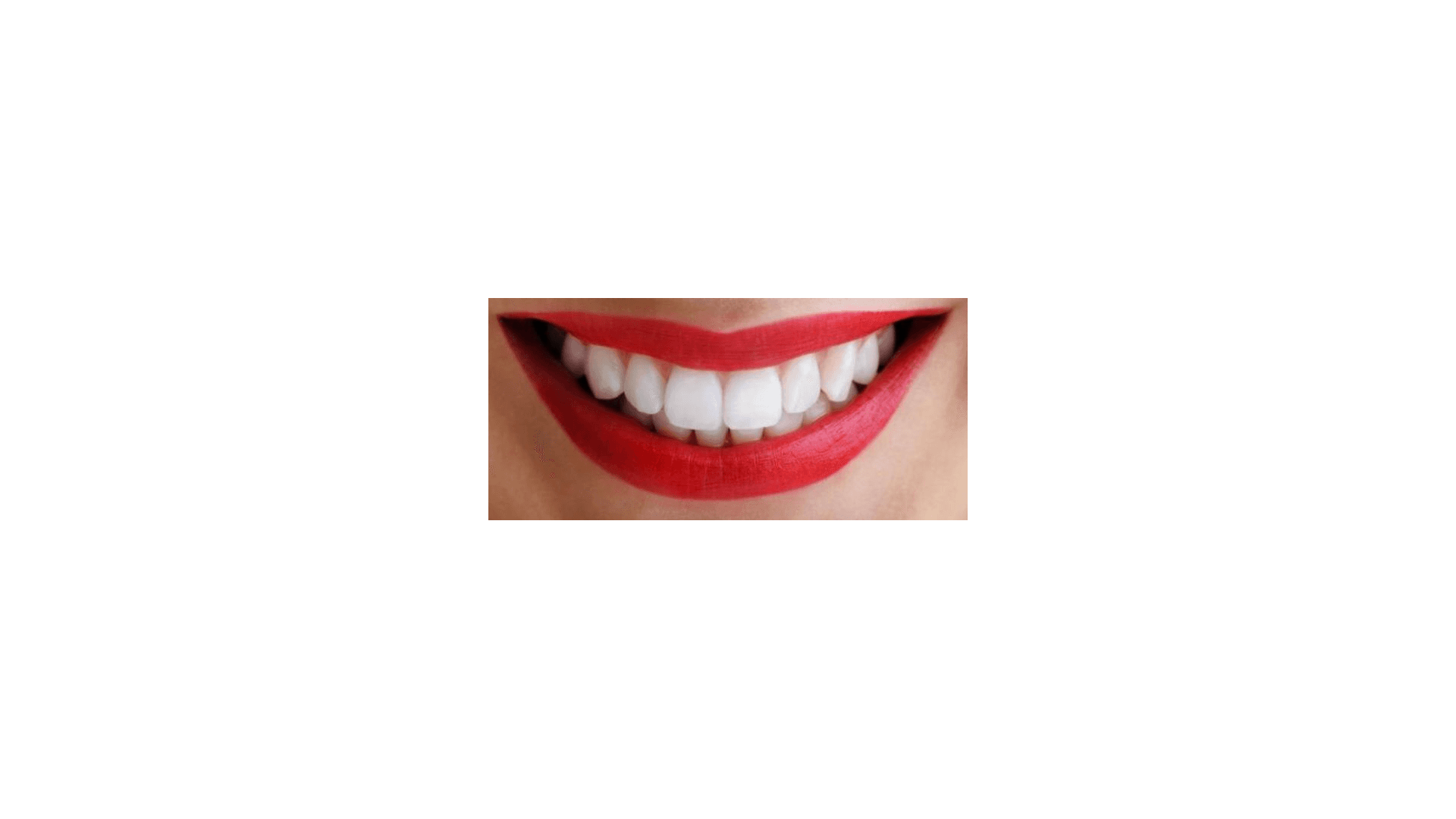 default-1